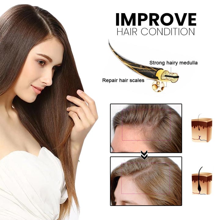 Thailand hair growth spray (Limited time offer )