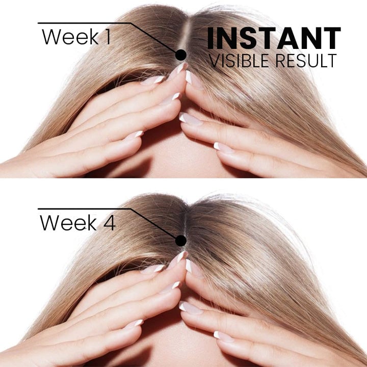 Thailand hair growth spray (Limited time offer )