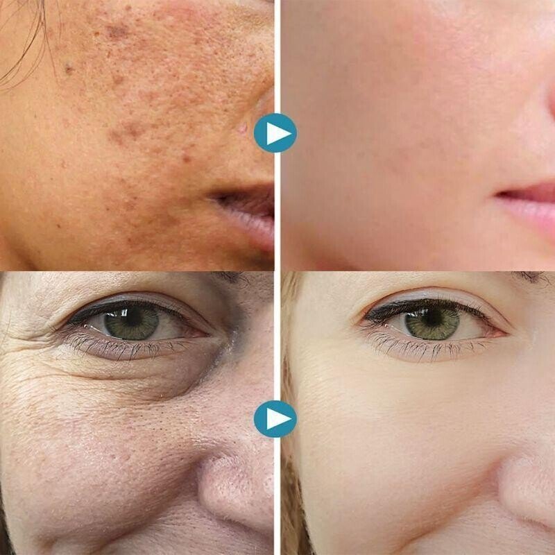 🔥HOT SALE🔥100%Natural&2025 Pore Invisible Cream