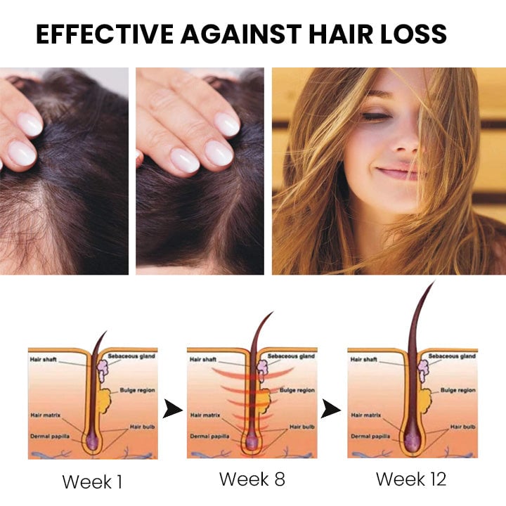 Thailand hair growth spray (Limited time offer )