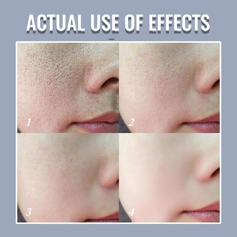 🔥HOT SALE🔥100%Natural&2025 Pore Invisible Cream