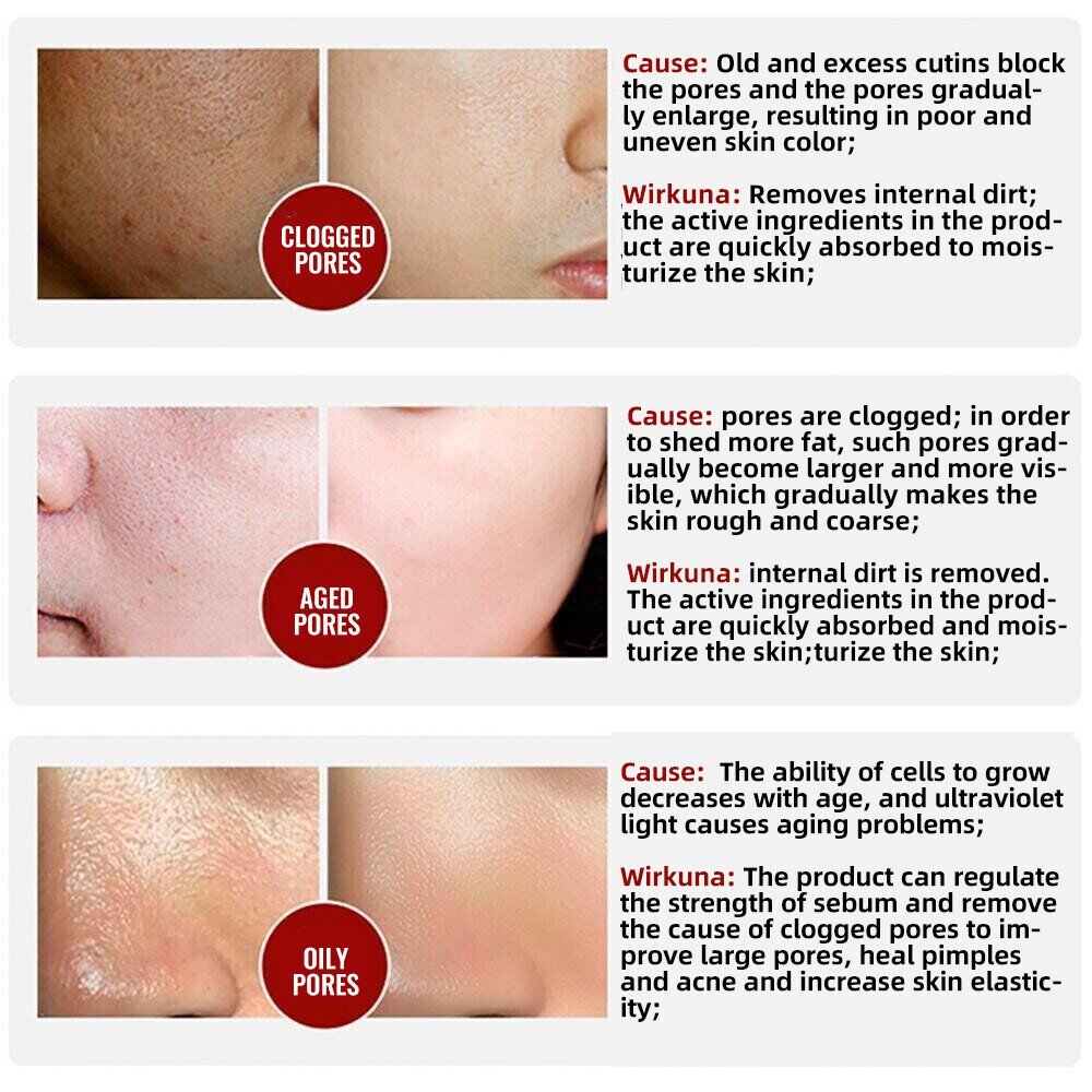 🔥HOT SALE🔥100%Natural&2025 Pore Invisible Cream